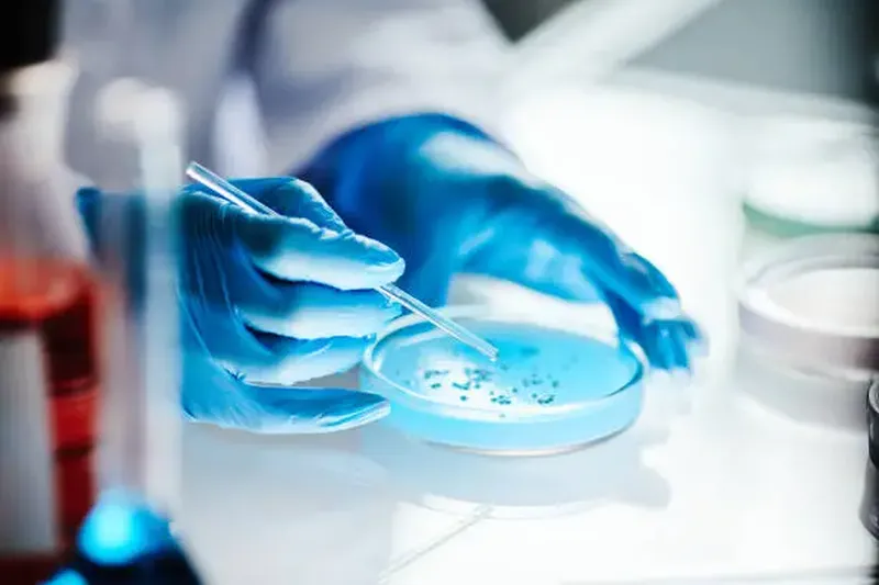 Petri dish culture analysis